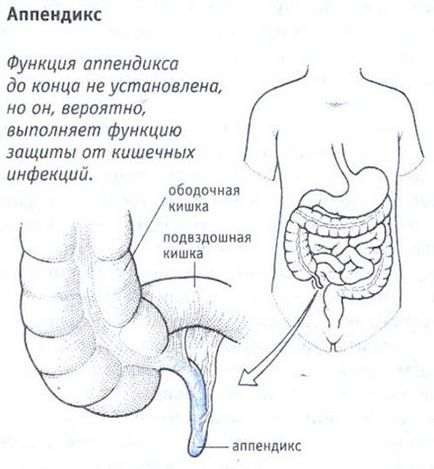 Flegmonoasă apendicita tratament, dieta dupa operatie, complicații și consecințe