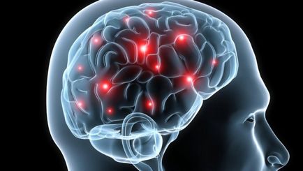 Hemoragică atacul cerebral - ce este, simptome, consecinte, tratament, prognostic