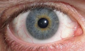 Heterocromie - diferite ochi de culori