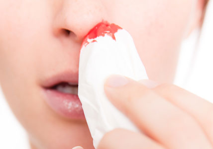 Sângerează din nas cauzează și cum să-l oprească