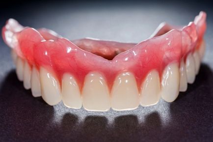 Ce dinți mai bine inserați tipuri de proteze și implanturi