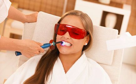 Cum de a albi dintii in metode de revizuire dentare