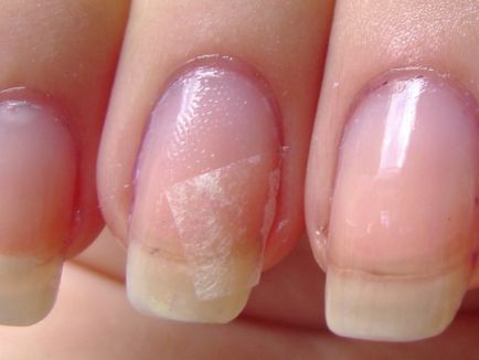 Cum sa faci o unghie ruptă - repararea și modalități de recuperare