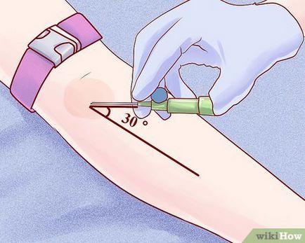 Cum de a pune un picurător 1