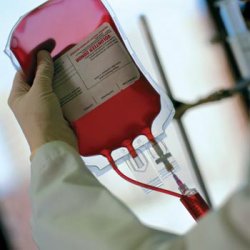 Cum se păstrează sângele, astfel încât să nu fie reduse, transfuzie - bisturiu - medical