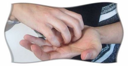 Ce mancarime semne de palmier din stânga (mâncărime) Ce mancarime a lăsat semne de palmier