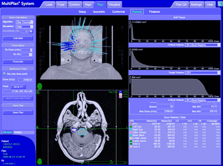 Cyberknife (CyberKnife), CyberKnife tratamentul cancerului