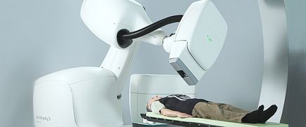 Cyberknife (CyberKnife), CyberKnife tratamentul cancerului