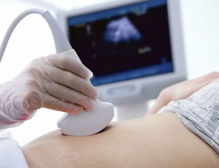Când a face prima ecografie în timpul sarcinii - atunci este mai bine pentru a merge la sondaj