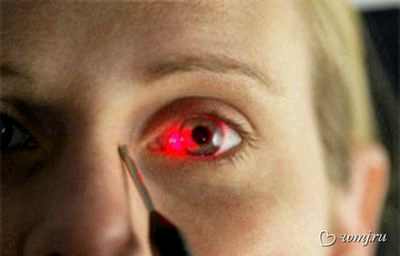 Noi moduri de a trata cataracta mod de a trata cataracta restaurarea vederii