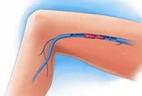 De ce rănit și durerile de picioare cauze, diagnostic