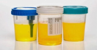 De ce urina este principalul motiv galben strălucitor pentru respingere