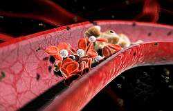 Cauzele colesterolului în sânge, ABC sănătate