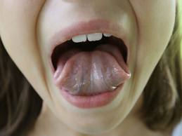 Conectați-vă să muște limba, buze sau obraz