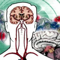 Simptomele de circulatie cerebrala - bisturiu - informații medicale și educație