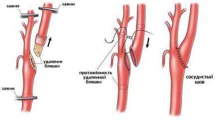 Artera carotidă este localizată și în cazul în care ar fi dacă apăsați