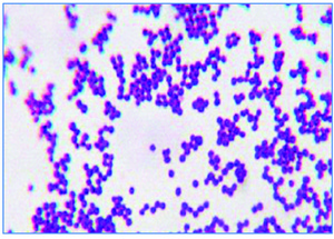 hemolitic Staphylococcus (Staphylococcus aureus hemolitic) la barbati simptome, frotiu și cultură la