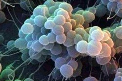 Staphylococcus haemolyticus bărbați modalități eficiente de a vindeca