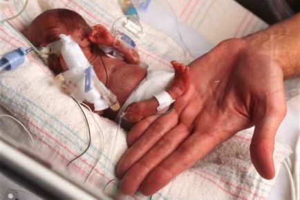 Convulsiile și tremor la nou-nascuti si copii sub un an ceea ce este, cauze