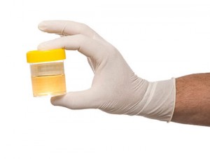 patologică urină închisă la culoare și cauze naturale