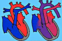 Transpunerea vaselor mari - cauze, simptome, diagnostic și tratament