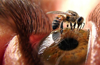 Muscata de țânțarul în ochi decât pentru a elimina umflarea și ce să facă primul ajutor