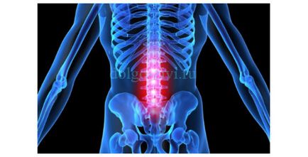 Exercitii pentru deformarea spatelui - un remediu universal pentru multe boli (medicament) Exercitii pentru deformarea spatelui - un remediu universal pentru multe boli