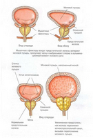 Urologice indicatii de masaj de prostata, tehnica de performanță