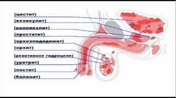 Urologice indicatii de masaj de prostata, tehnica de performanță