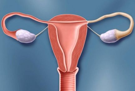 Creșterea grosimii endometrului care determină duce la această