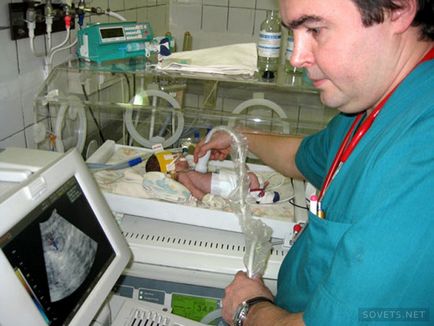 Uzi inima nou-născut - modul în care procedura de, mărturii, clipuri video și fotografii