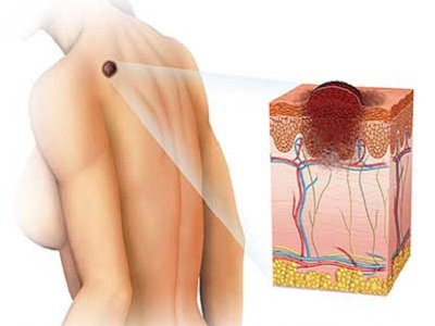 Hirurgiya- Centrul Medical 