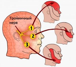 як лікувати невралгію шиї в домашніх умовах