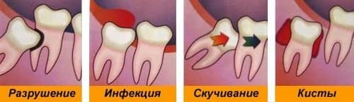 боляче лікувати ясна