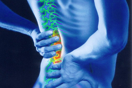 гіпертрофія жовтих зв'язок хребта що це таке симптоми лікування розтягнення спини звапніння передня поздовжня
