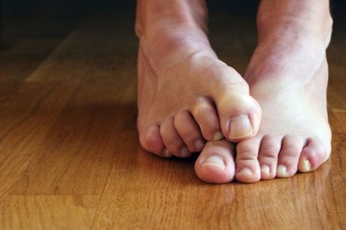 як вилікувати поганий запах ніг