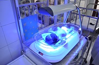 як лікують жовтяницю у новонароджених в лікарні