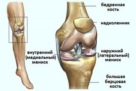 меніск колінного суглоба лікування без операції