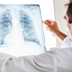 як лікувати туберкулема легких