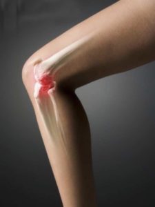 артроз колінного суглоба лікування народними засобами