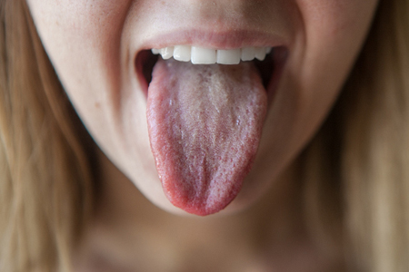 як лікувати шорсткий язик