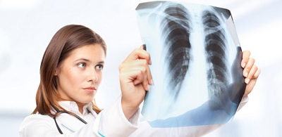хронічна обструктивна хвороба легень