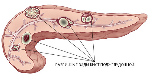 поодинокі