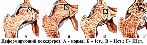 профілактика