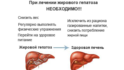 як лікувати гепатоз печінки