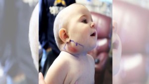 як лікувати лімфовузли на шиї у дитини
