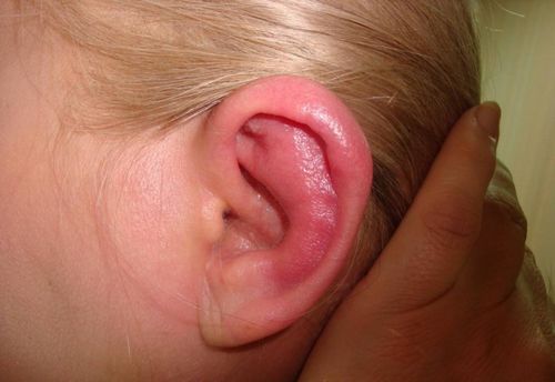 як лікувати отит зовнішнього вуха