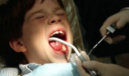 як лікувати зуби маленьким дітям