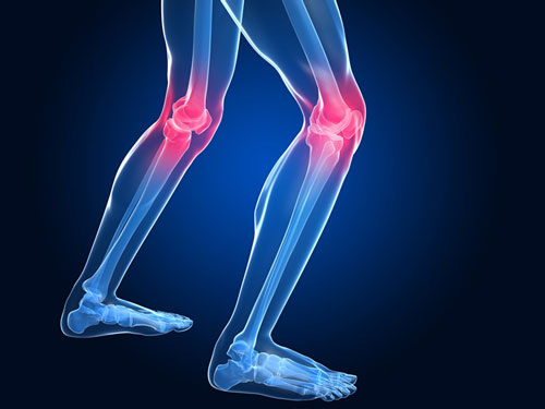 як лікувати остеопороз коліна