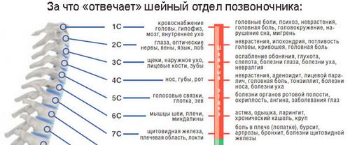 як лікувати остеохондроз у дітей